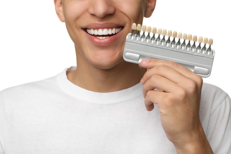 ציפוי שיניים זירקוניה